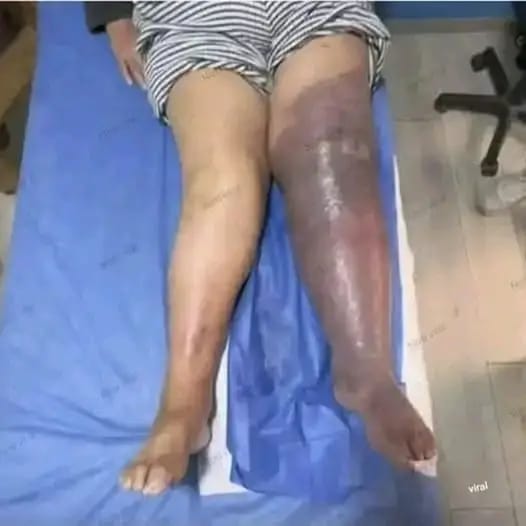 These are the consequences of sleeping with a 2…See more