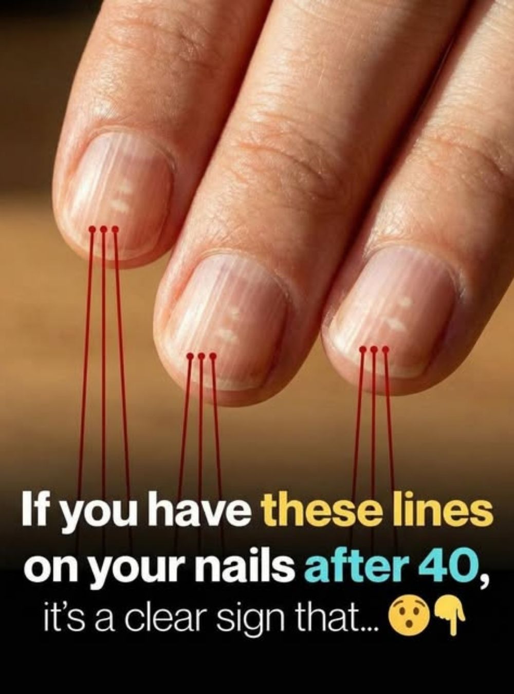 Why Vertical Lines Commonly Appear on Fingernails as You Get Older