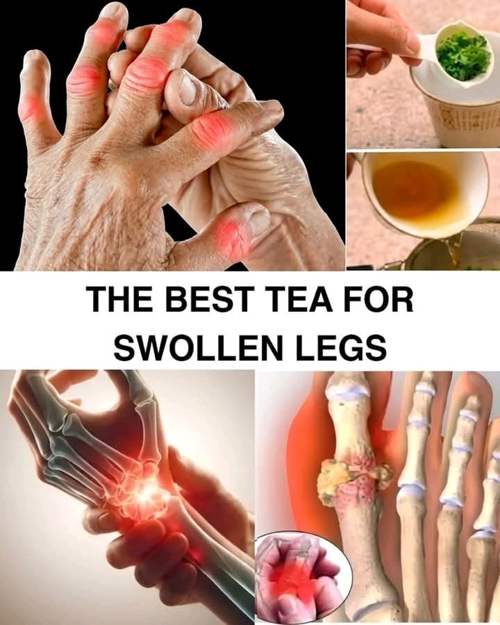 The Simple Tea That Could Help You Say Goodbye to Swollen Legs for Good