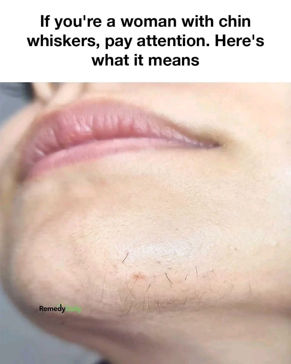 What Chin Whiskers Could Be Telling You About Your Health