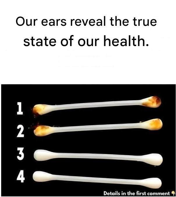 Search Results for: Our ears reveal the true state of our health