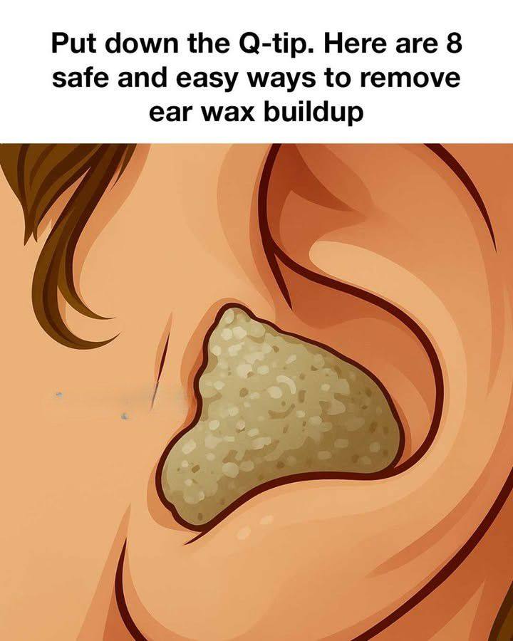 Put down the Q-tip. Here are 8 safe and easy ways to remove ear wax buildup